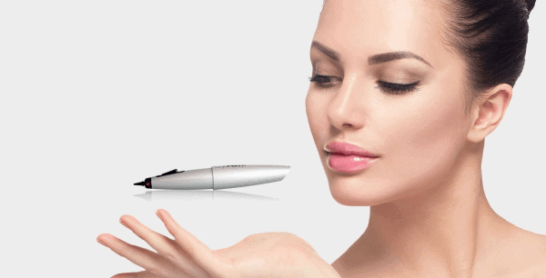 CryoPen Cryotherapy Stoulton