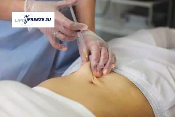 How Does Aqualyx Fat Dissolving Injection Work to Break Down Fat Stoulton?