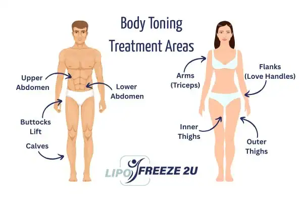 Graphic showing where you can have Body toning Treatment Stoulton on your body