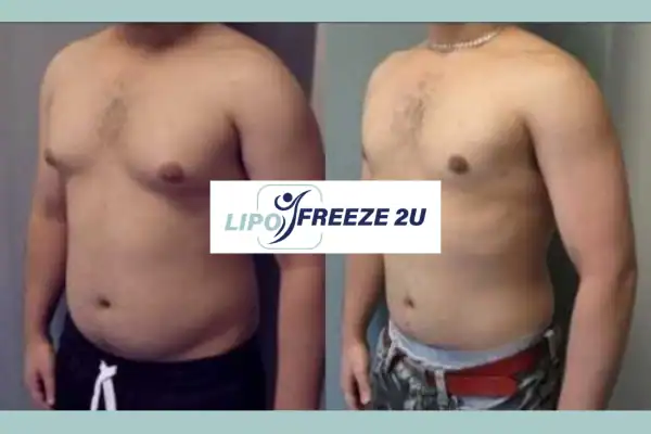 How Long Does It Take to See Results Stoulton?