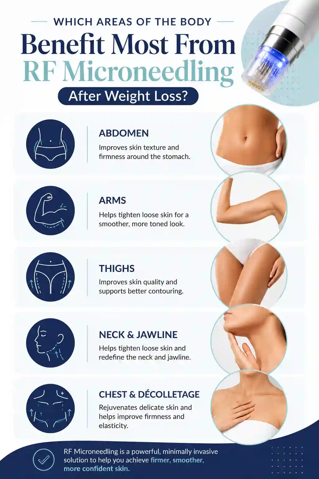 Which Areas of the Body Benefit Most From RF Microneedling After Weight Loss Stoulton